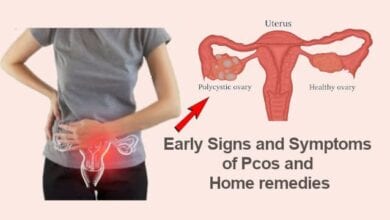 Early Signs and Symptoms of Pcos