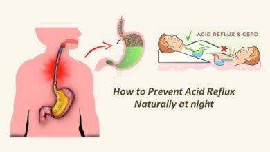 How to Prevent Acid Reflux Naturally