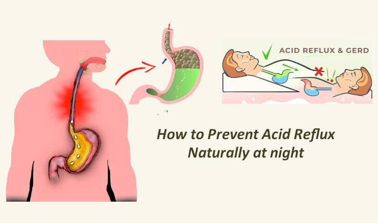 How to Prevent Acid Reflux Naturally