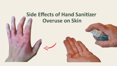 Side Effects of Hand Sanitizer Overuse on Skin