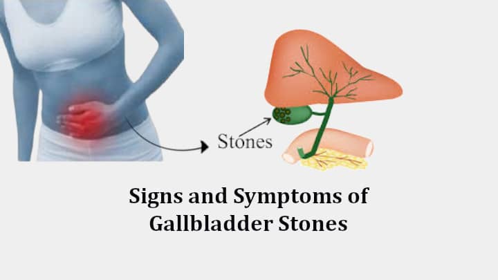 Signs and Symptoms of Gallbladder Stones