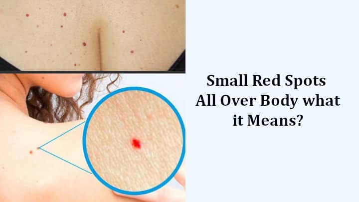 Red Spots on skin All Over Body