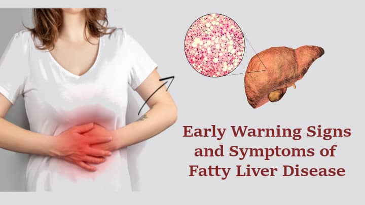 Signs and Symptoms of Fatty Liver Disease