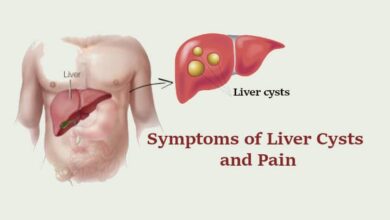 Symptoms of Liver Cysts and Pain
