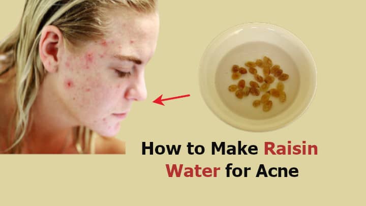 How to Make Raisin Water For Acne