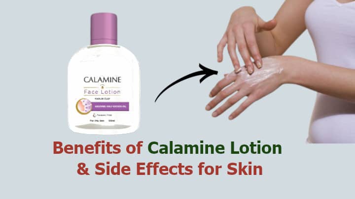 Benefits of Calamine Lotion and Side Effects on face