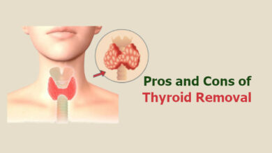 Pros and Cons of Thyroid Removal
