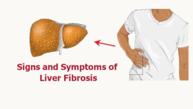 Signs and Symptoms of Liver Fibrosis