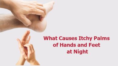 What Causes Itchy Palms of Hands and Feet at Night