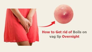 How to Get rid of Boils on vag lip