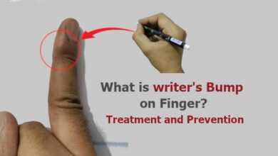 writer's Bump on Finger