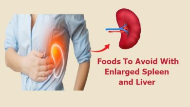 Foods to Avoid with Enlarged Spleen
