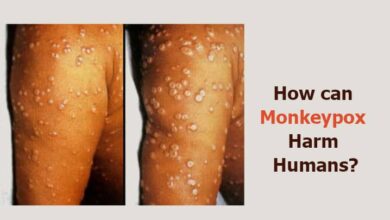 How can Monkeypox Harm Humans