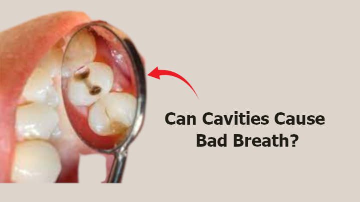 Can Cavities Cause Bad Breath
