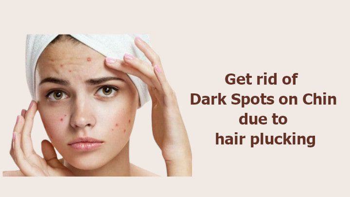 How to Get Rid of Dark Spots On Chin due to hair plucking