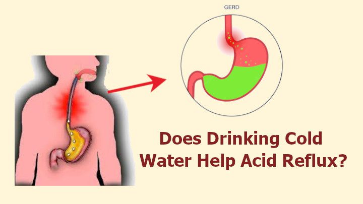 Does Drinking Cold Water Help Acid Reflux
