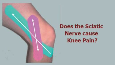 Does the Sciatic Nerve cause Knee Pain