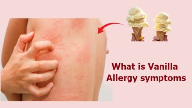 Vanilla Allergy Symptoms