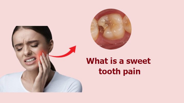 What is a sweet tooth pain