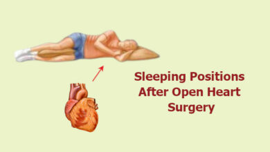 Sleeping Positions After Open Heart Surgery