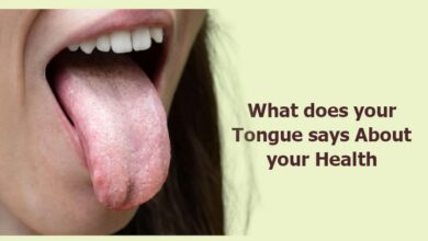 What does your Tongue says About your Health