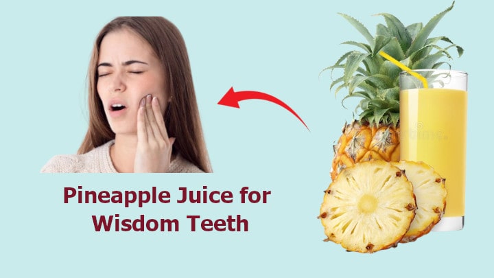 Does Drinking Pineapple Juice Help with Wisdom Teeth