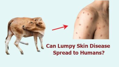 Lumpy Skin Disease in Humans Symptoms