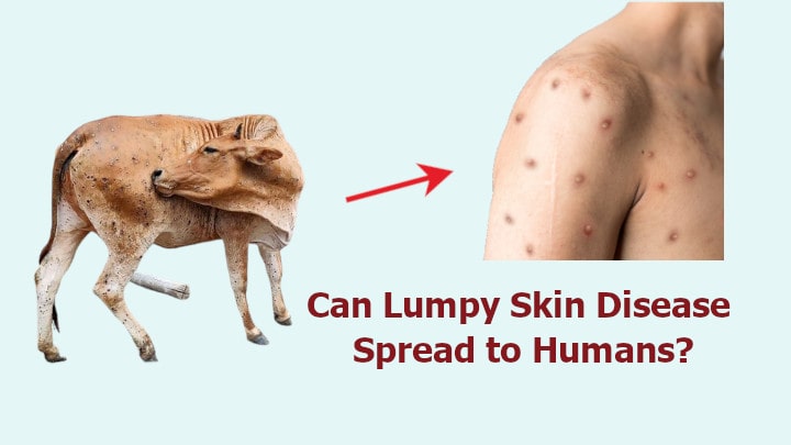 Lumpy Skin Disease in Humans Symptoms