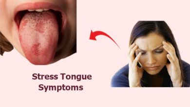 Stress Tongue Symptoms