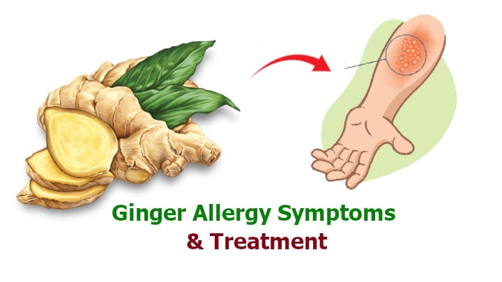 Ginger Allergy Symptoms