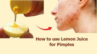 How to use Lemon for Pimples