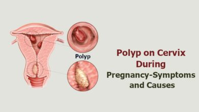 Polyp on Cervix During Pregnancy