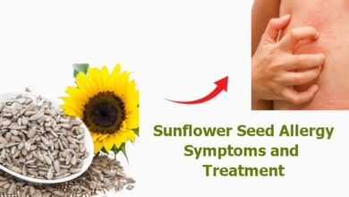 Sunflower Seed Allergy Symptoms