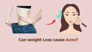 Can weight Loss cause Acne
