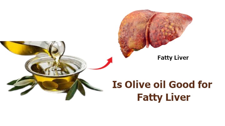 Is Olive oil Good for Fatty Liver