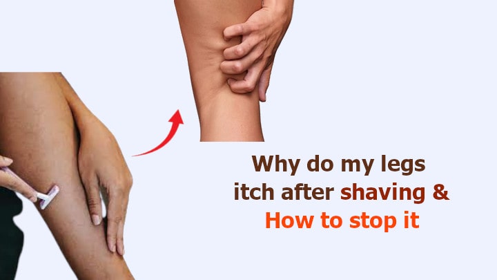 Why do my legs itch after shaving