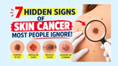 hidden signs of skin cancer