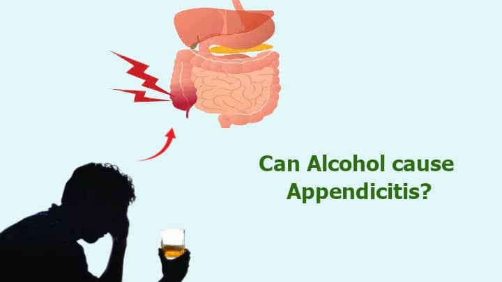 Can Alcohol cause Appendicitis
