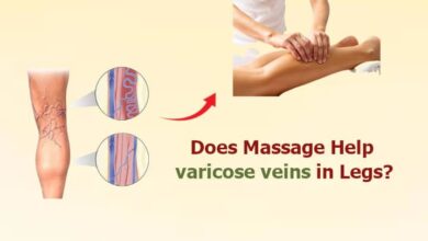 Does Massage Help varicose veins