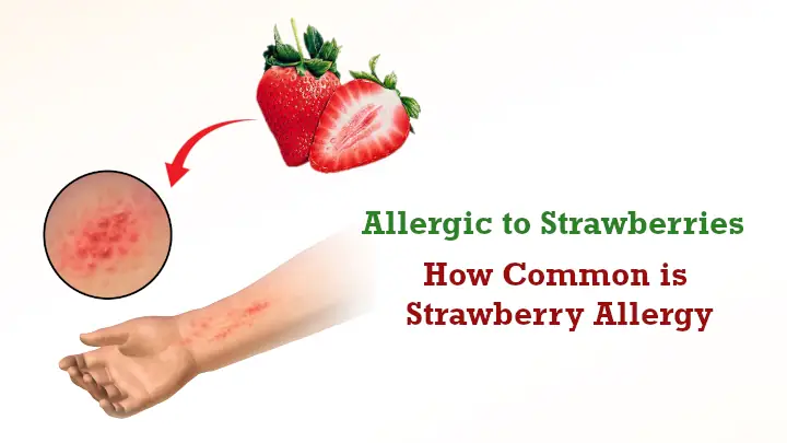 Allergic Reaction to Strawberries