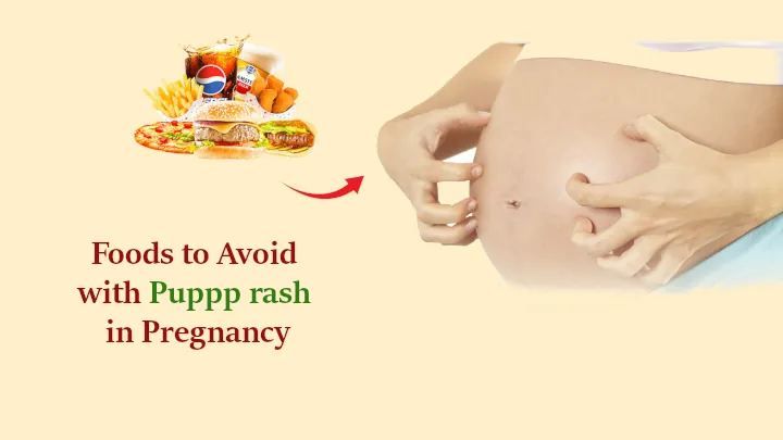 Foods to Avoid with Puppp rash