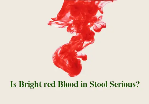 Is Bright red Blood in Stool Serious