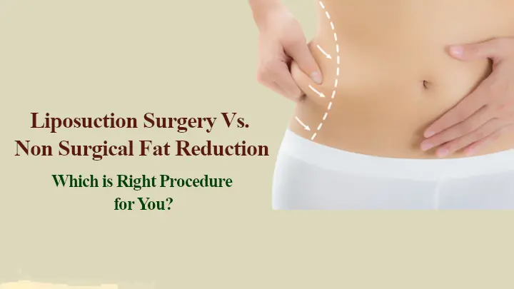 Liposuction Surgery vs. Non Surgical Fat Reduction