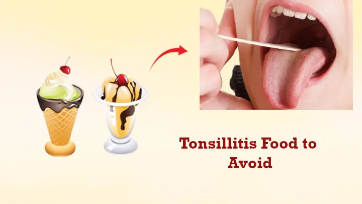 Tonsillitis Food to Avoid