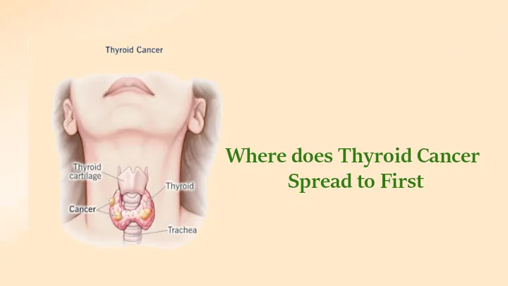 Where does Thyroid Cancer Spread to First