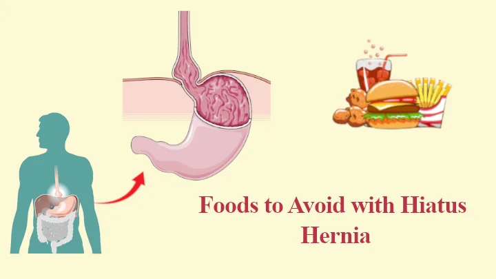 Foods to Avoid with Hiatus Hernia