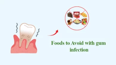 Foods to Avoid with gum Infection