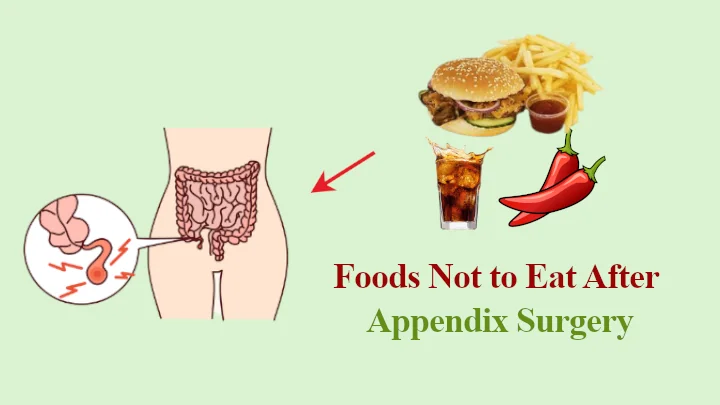 List of Foods Not to Eat After Appendix Surgery