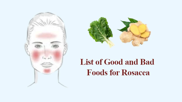 List of Good and Bad Foods for Rosacea