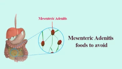 Mesenteric Adenitis foods avoid